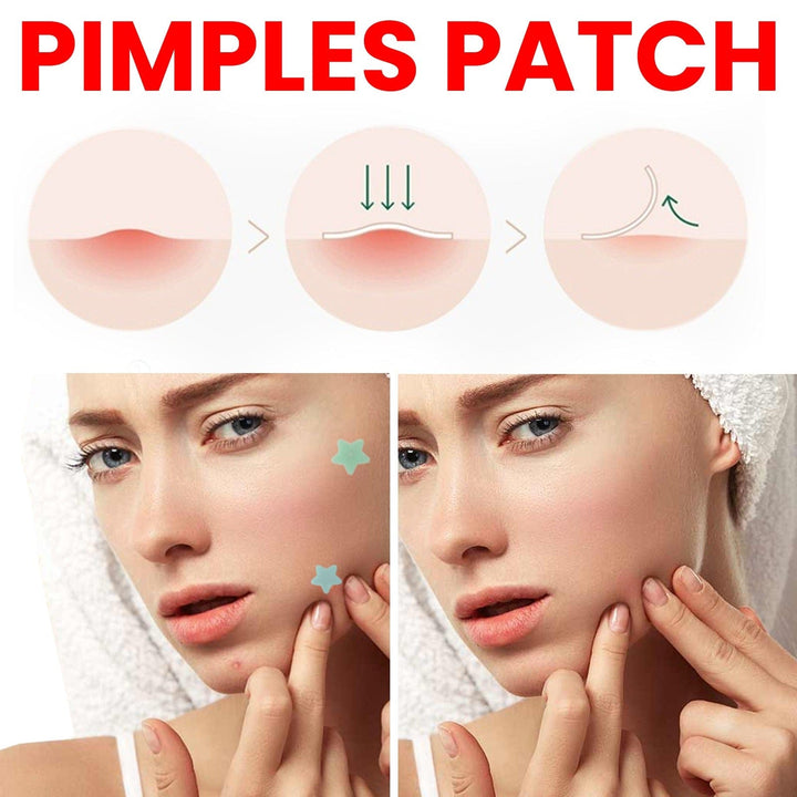 Repair Acne Patch protective barrier against dust and contact