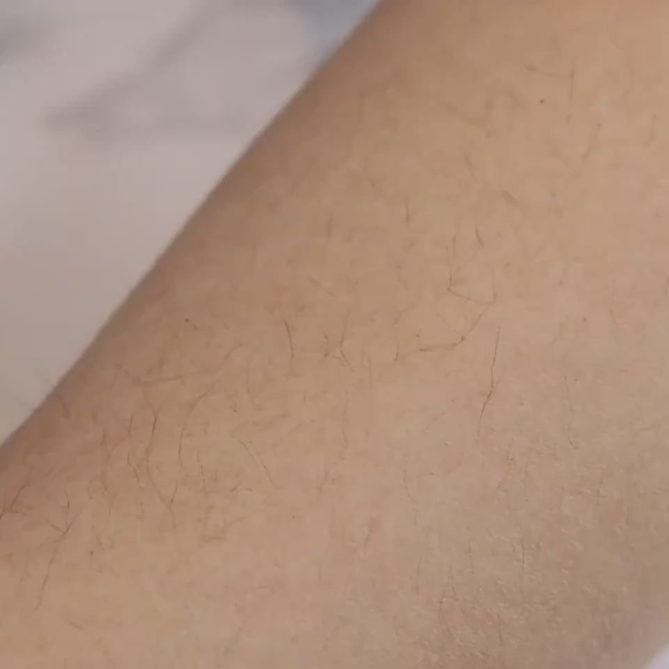 Non-Irritating Hair Removal Foam for Smooth, Radiant Skin